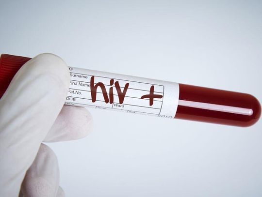 Coraz więcej przypadków HIV w Polsce